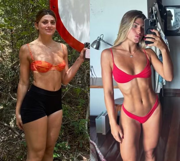 Filha modelo de Eduardo Moscovis posta antes e depois: ‘Não é mudar, é lapidar’