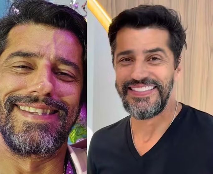 Ex-BBB Alberto Cowboy adere lentes de contato nos dentes e exibe novo sorriso