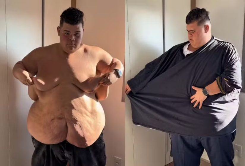 Após perder 130kg, Gordão da XJ mostra evolução e desabafa: ‘Muito difícil”